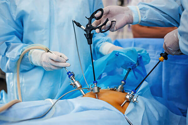 Λαπαροσκοπική χειρουργική: Αφαίρεση Ινομυωμάτων, Ενδομητρίωση, Υστερεκτομή, Αφαίρεση κύστης, Πολύποδας